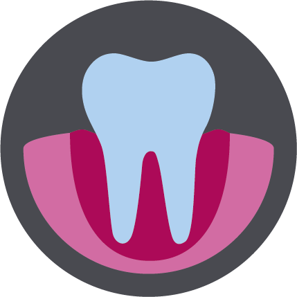 par parodontose parodontitis zahn zahnarzt praxis gesunde zähne zahnfleisch
